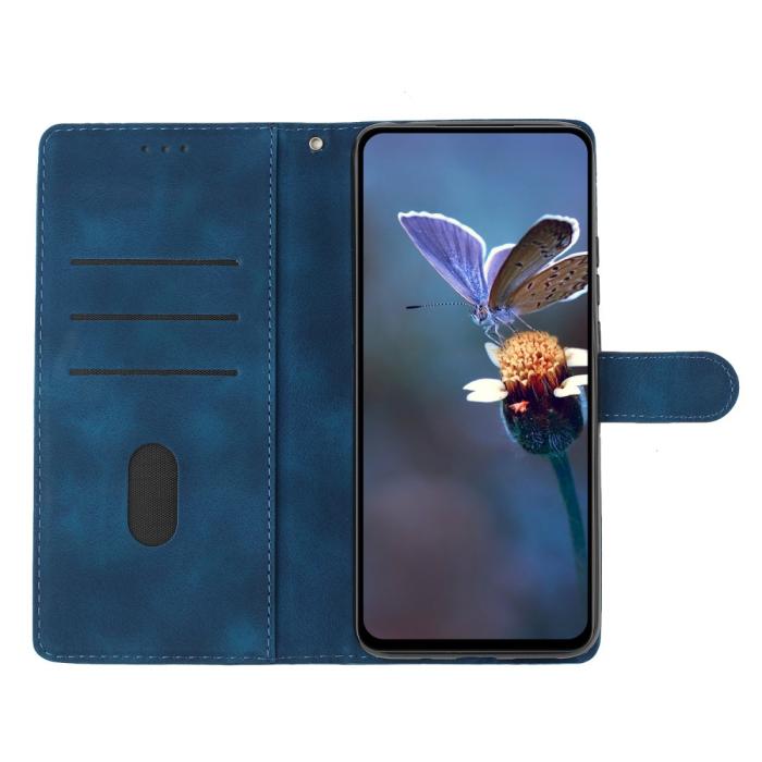 Bild 3,  Samsung Galaxy A36 5G/A56 5G Fodral Med Blommigt Tryck - Teknikhallen.se