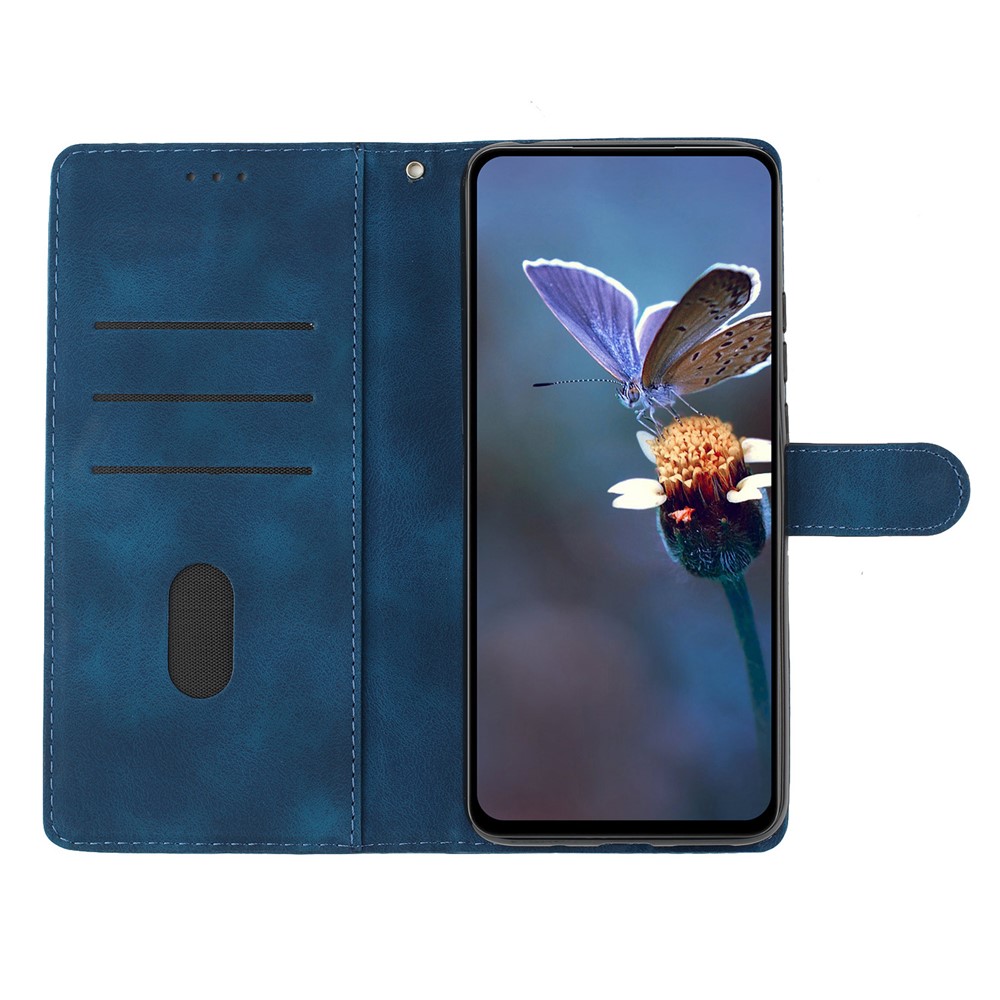  Samsung Galaxy S26 Ultra Fodral Med Blommigt Tryck Läder Blå - Teknikhallen.se